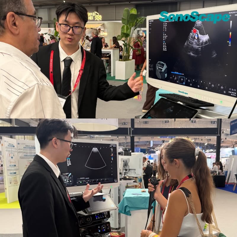 Banner SonoScape /CHINA/ Advanced medical imaging